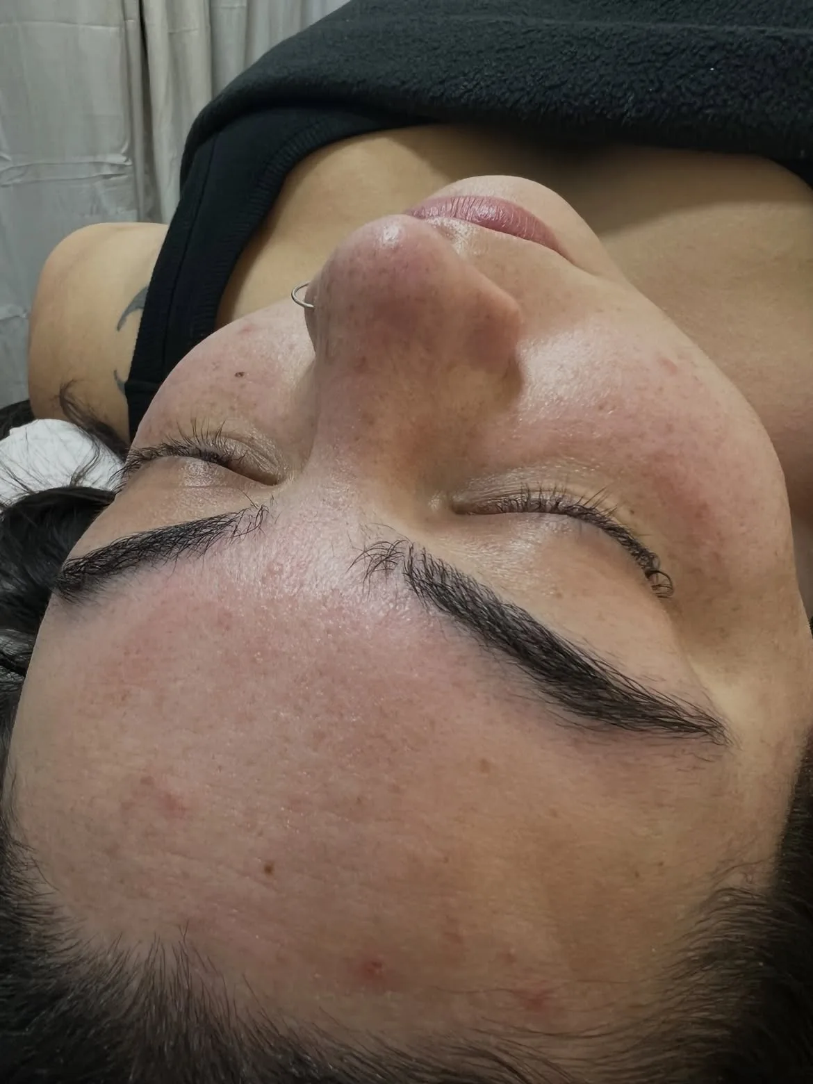 Después de limpieza facial profunda