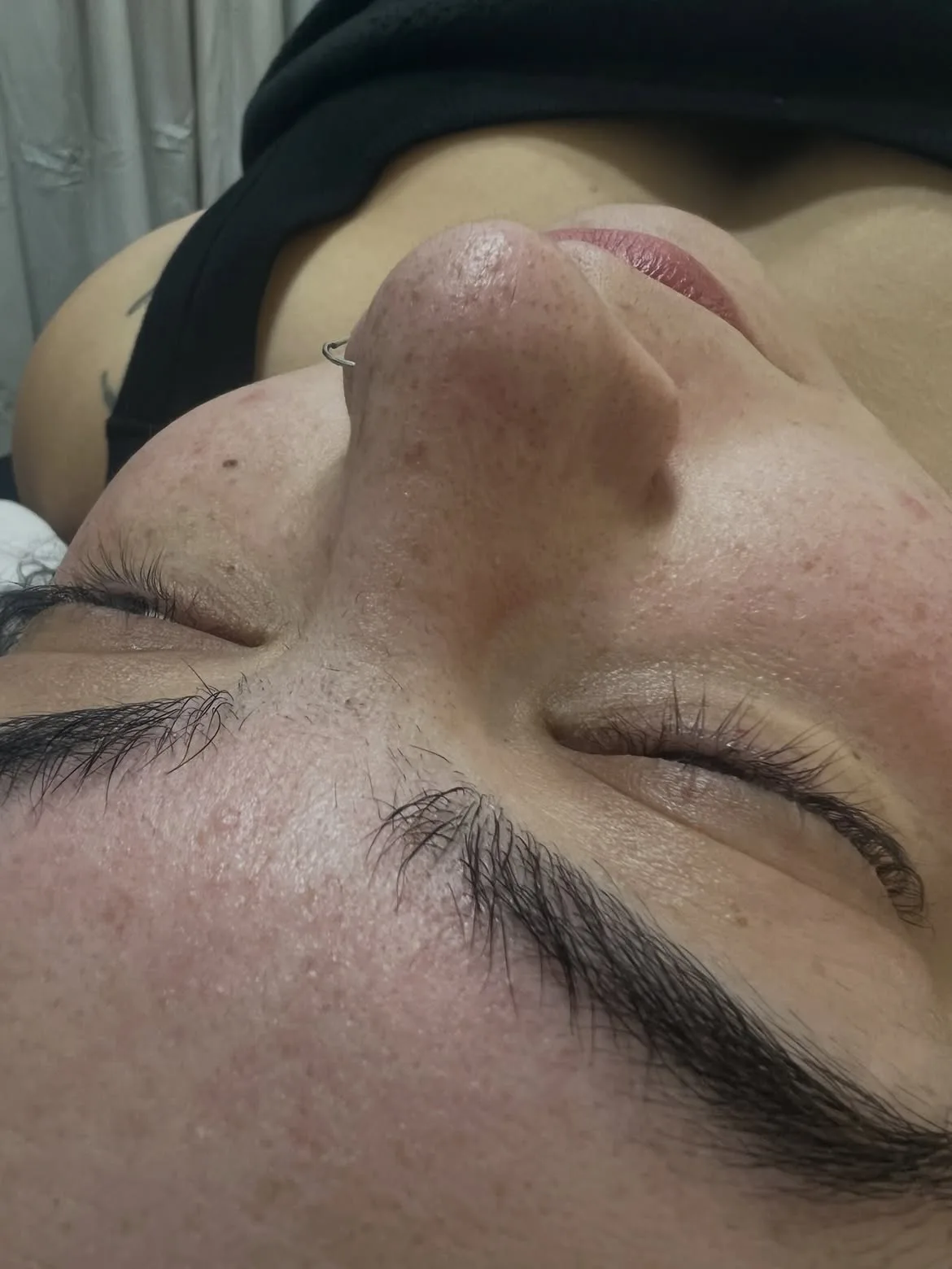 Antes de limpieza facial profunda